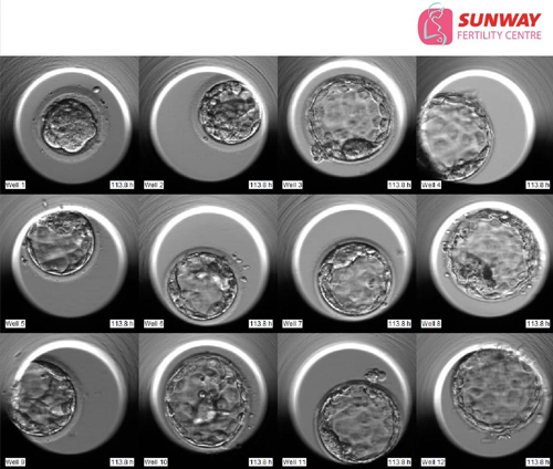 Time-Lapse Technology | Sunway Fertility Centre IVF